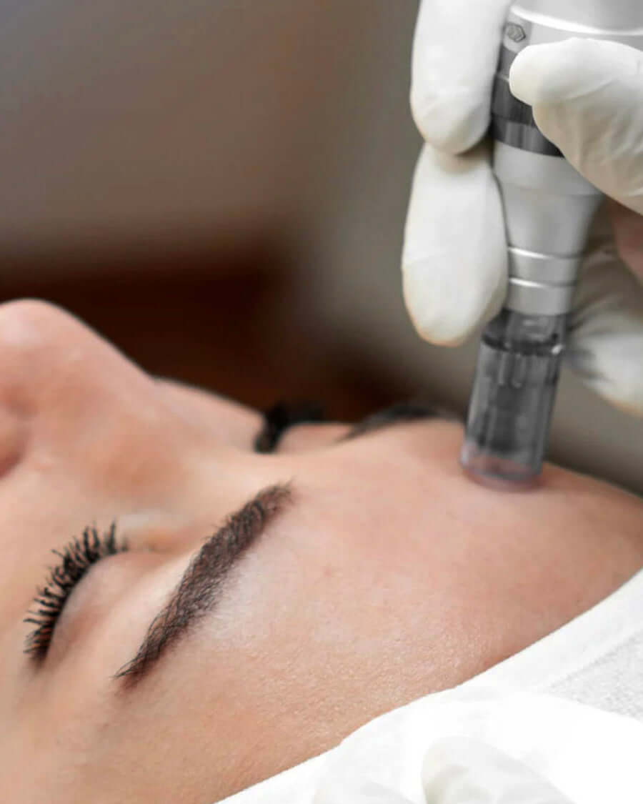 Mesotherapy treatment in Montreal at Clinic Unica